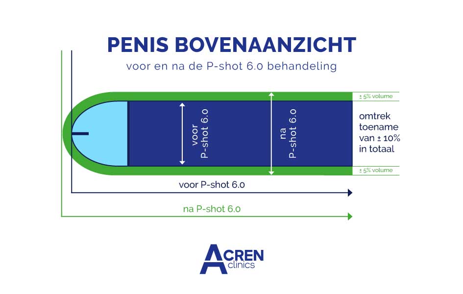 Penis filler